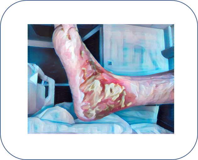 Fichier:Ulcère titre.png