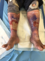 Grosses jambes suintantes20.png