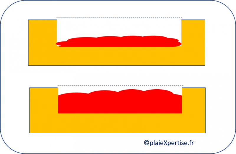 Fichier:Tissu de granulation normal1.png