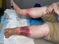 Grosses jambes suintantes53.jpg