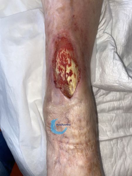 Fichier:Cou de pied98.jpg