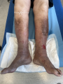 Dermiteocre46.png