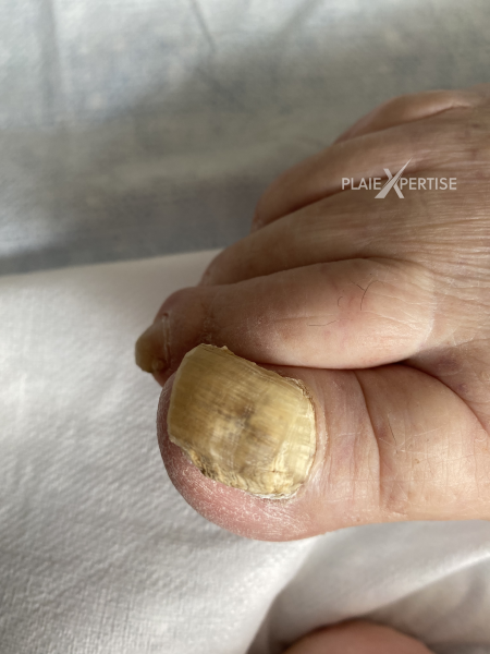 Fichier:Ongles25.png