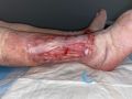 Tendon normal50.jpg