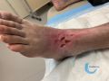 Cou de pied76.jpg