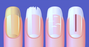 Ongles.png
