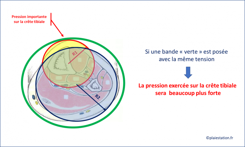 Fichier:Veine18.png