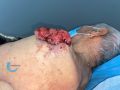 Nodule4.jpg