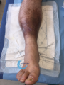 Dermiteocre59.png