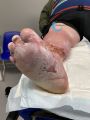 Grosses jambes suintantes41.jpg