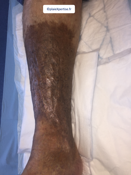 Fichier:Dermiteocre23.png