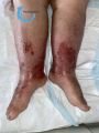 Grosses jambes suintantes45.jpg