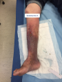 Dermiteocre17.png