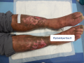 Dermiteocre31.png