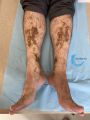 Dermiteocre79.jpg