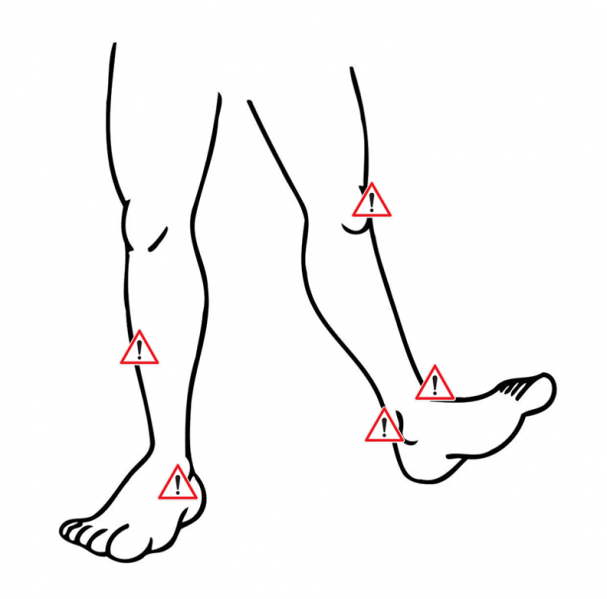 Fichier:Zones à risque.png