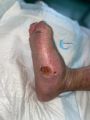 Charcot57.jpg