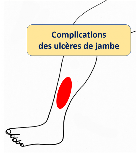 Fichier:Complications.png
