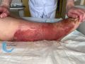 Grosses jambes suintantes46.jpg