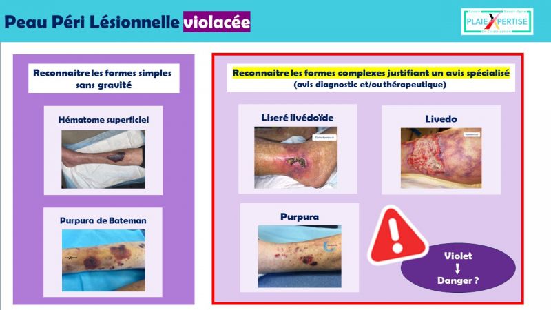 Fichier:Fiche PPL violacée.jpg