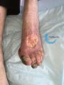 Cou de pied66.jpg