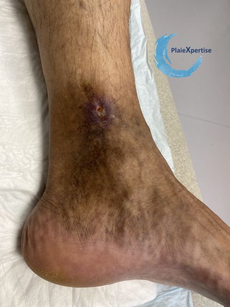 Fichier:Dermiteocre71.jpg