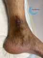 Dermiteocre71.jpg