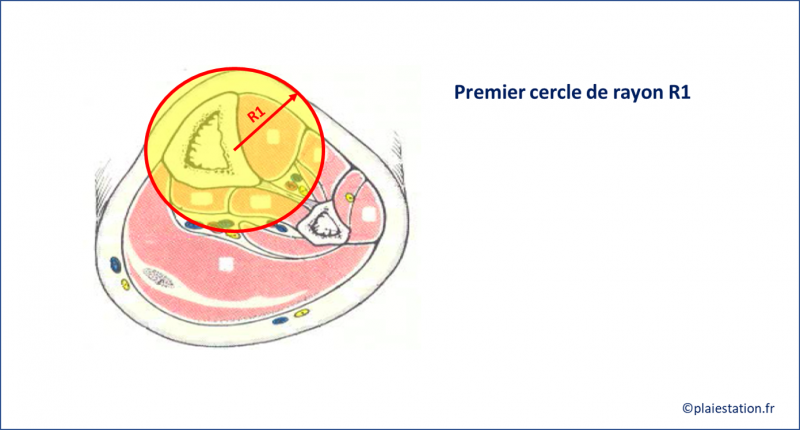 Fichier:Veine16.png