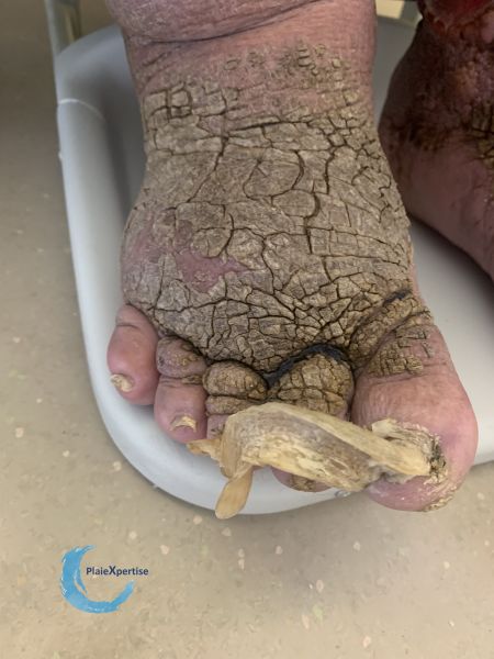 Fichier:Ongles77.jpg