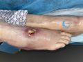 Cou de pied82.jpg