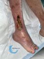 Calcifications38.jpg