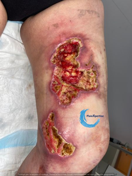 Fichier:Clciphylaxie 26.jpg