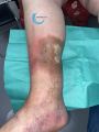 Dermiteocre83.jpg