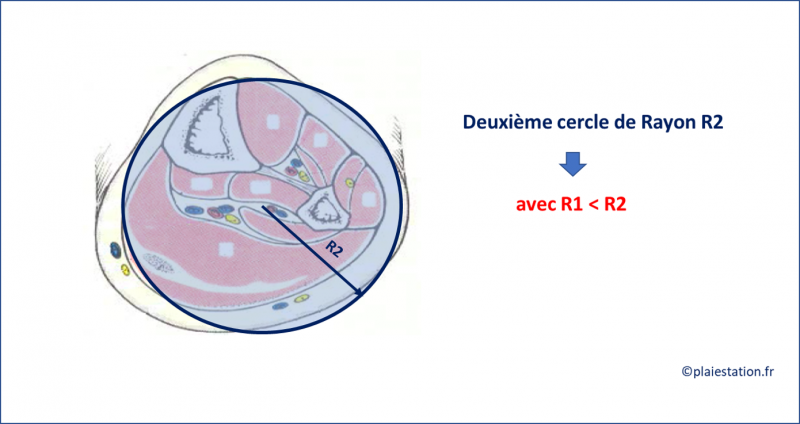 Fichier:Veine17.png