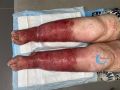 Dermite d'irritation180.jpg