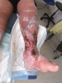 Grosses jambes suintantes23.png