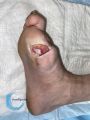 Amputation6.jpg