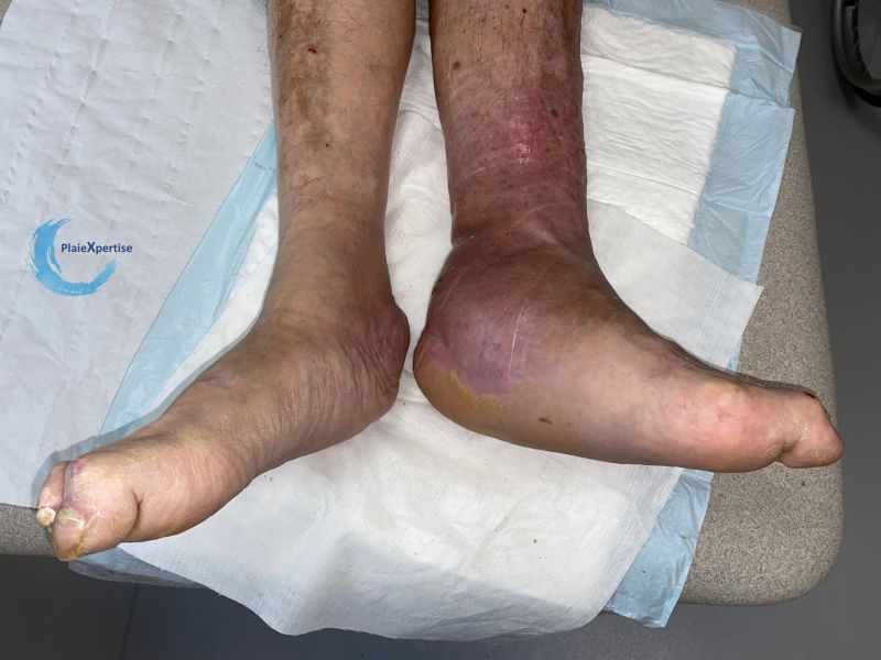 Fichier:Charcot1.jpg