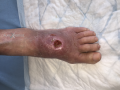 Cou de pied38.png