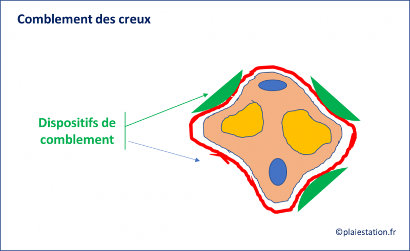 Fichier:Veine23.png