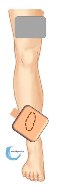 Fichier:Woundel16.jpg