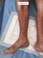 Dermiteocre21.png