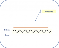 Atrophie(LE).png