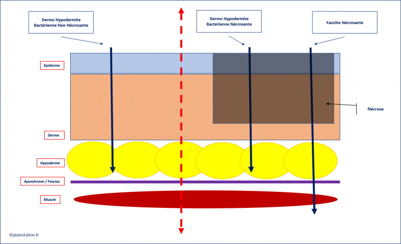 Fichier:DHB.png