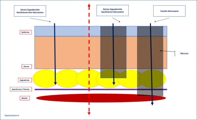 Fichier:DHB1.png