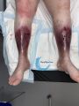 Dermiteocre68.jpg