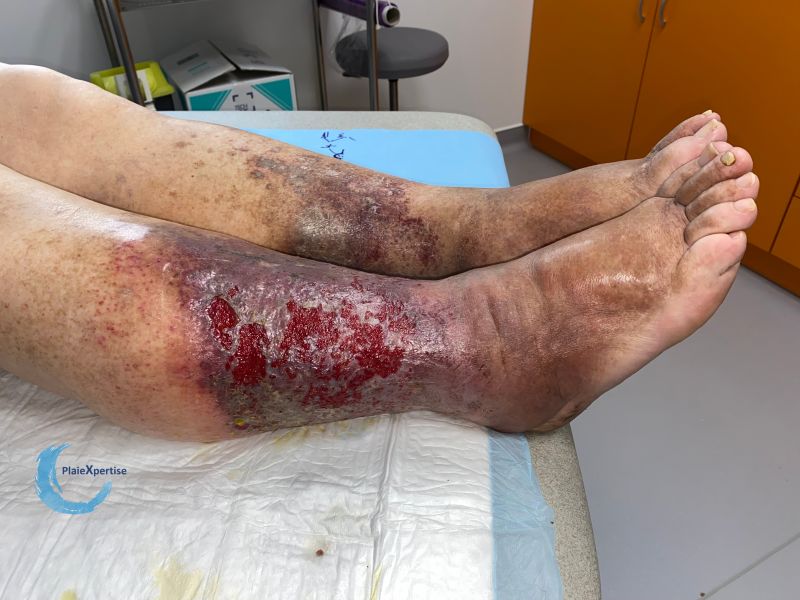 Fichier:Dermiteocre88.jpg