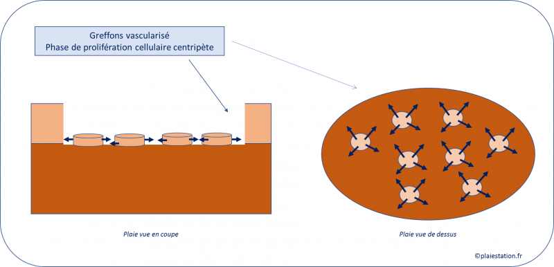 Fichier:6. Epidermisation centrifuge.png