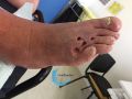 Cou de pied63.jpg