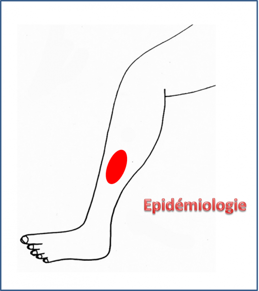 Fichier:UDJ Epidemiologie.png